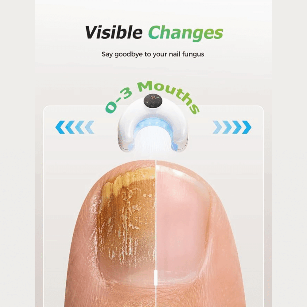 Okita Nail Fungus Light (official Retailer) 2025